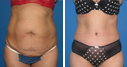 Before & After Photos